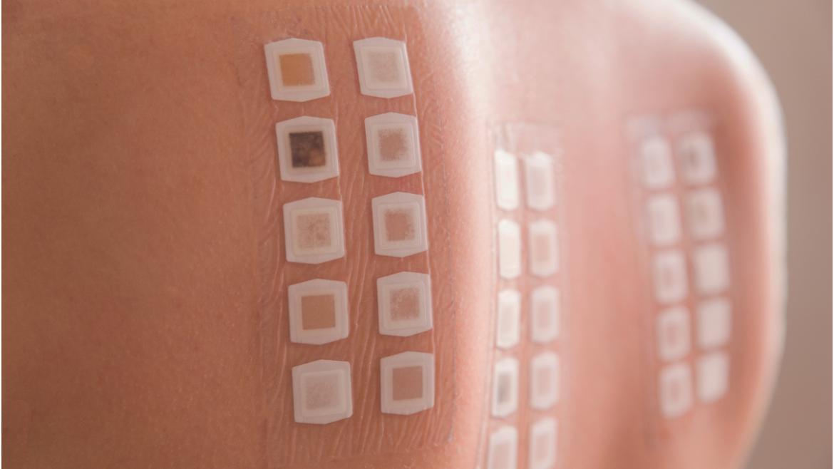 Patch test